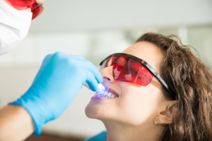Why Professional Teeth Whitening Delivers More Predictable Results Than Store-Bought Products